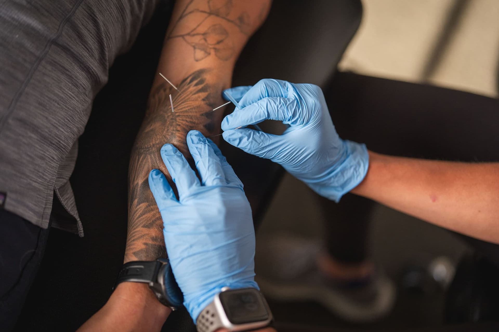 Dry needling treatment with electrical stimulation